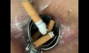 Speculum opens a unfenced gap to pack on touching freezing cook added to ashtray